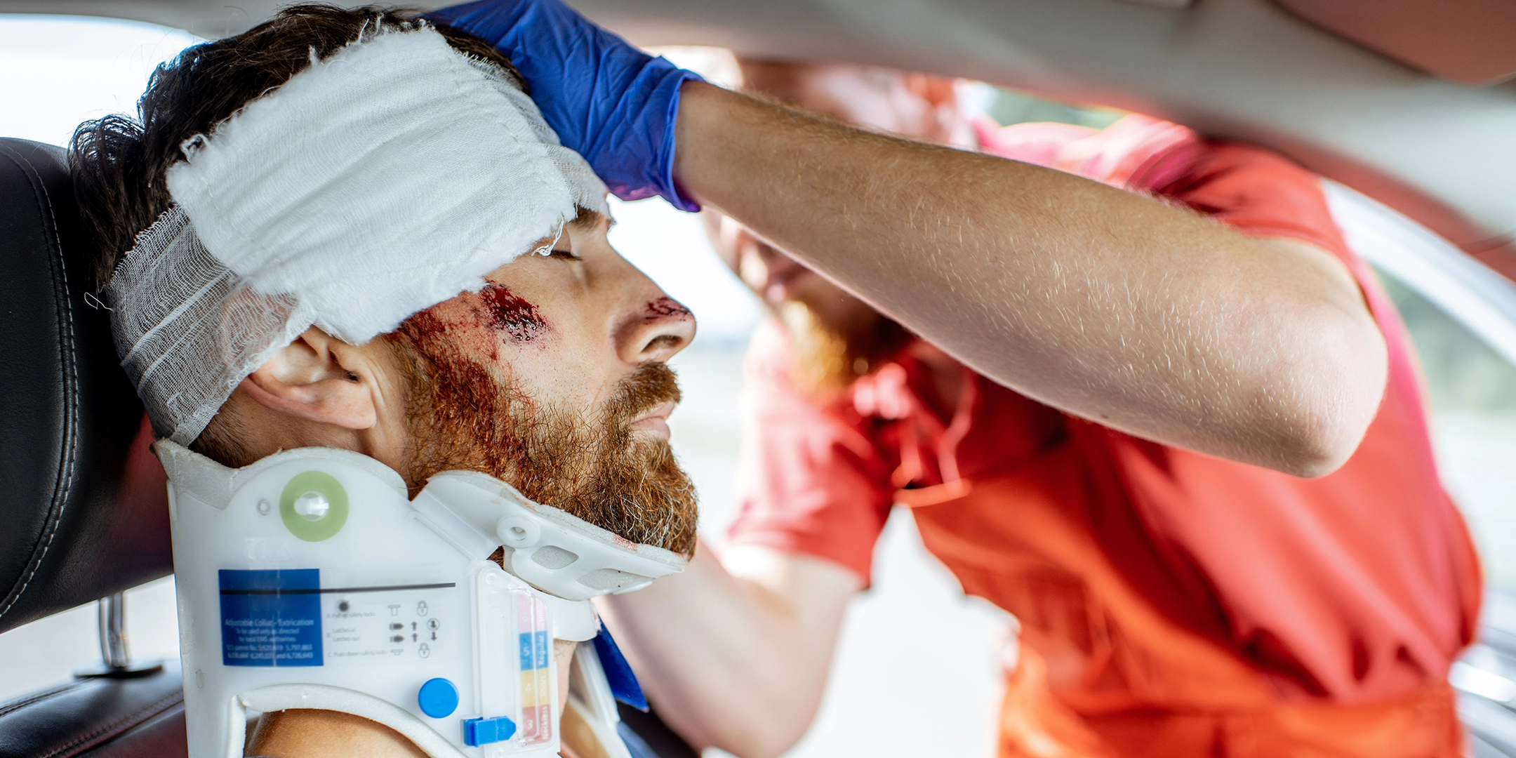 TMJ Injury After A Motor Vehicle Accident: Clinical Findings Attorneys Should Understand